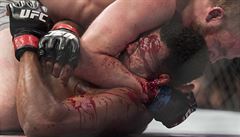 VIDEO: Jako z hororového filmu. V UFC tekly decilitry krve za vteřinu