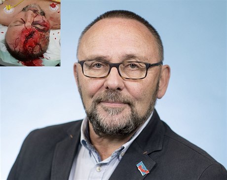 Poslance a éfa regionální odboky Alternativy pro Nmecko (AfD) v Brémách...