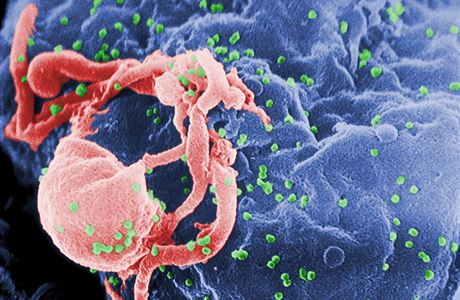 HIV (zelený) vylézá z pstované bílé krvinky