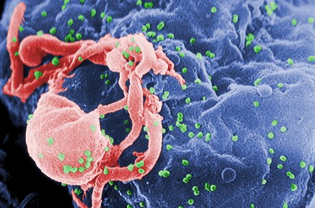 HIV (zelený) vylézá z pěstované bílé krvinky