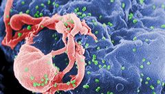 Hrozba AIDS v Česku vzrostla. Přibylo nejvíce nových případů v historii