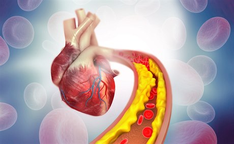 Cholesterol (ilustraní foto)