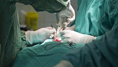 Olomoucký lékař vyvinul nový meziobratlový implantát z titanu
