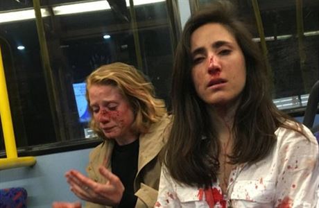 Lesbický pár zmlátili neznámí útoníci v londýnském autobuse. Omítly se políbit