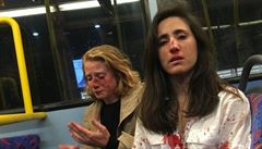 Lesbický pár zmlátili neznámí útočníci v londýnském autobuse. Omítly se políbit | na serveru Lidovky.cz | aktuální zprávy