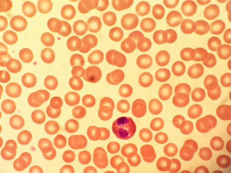 Mikroskopický snímek lidské krve. Pevládají ervené krvinky, které jsou pi...