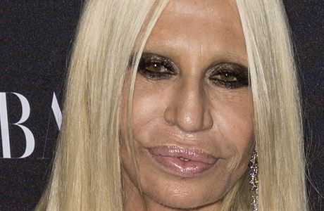Mdn nvrhka Donatella Versace to splastikami pehn. Botoxov injekce a...