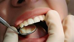 Na zubní prevenci mají chodit i lidé s celkovou snímací náhradou