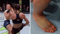Joanna Jedrzejczyková zvítězila v zápase UFC se zlomeným chodidlem.