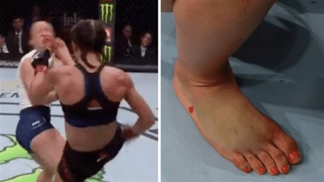 Joanna Jedrzejczyková  zvítzila v zápase UFC se zlomeným chodidlem.