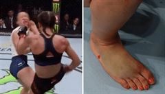 Joanna Jedrzejczyková  zvítězila v zápase UFC se zlomeným chodidlem. | na serveru Lidovky.cz | aktuální zprávy