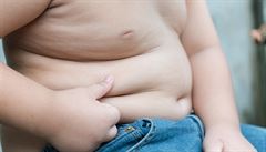 České děti se nevhodně stravují. V dospělosti jim hrozí problémy
