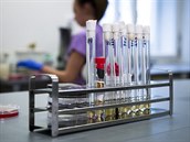 Laborato provující vzorky od pacient s podezením na nákazu koronavirem.