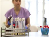 V centrální laboratoi testují vzorky od pacient, u kterých se objevilo...