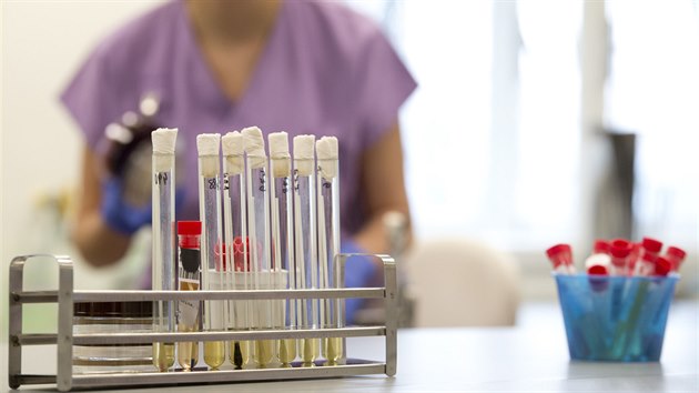 V centrální laboratoi testují vzorky od pacient, u kterých se objevilo...