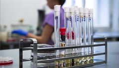 Laboratoř prověřující vzorky od pacientů s podezřením na nákazu koronavirem.