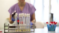 Testy na nákazu koronavirem podstoupilo v Česku 62 lidí. Výsledky u všech jsou negativní