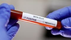 Testování koronaviru (ilustraní snímek).