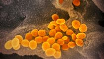 Mikroskopick snmky koronaviru zveejnili vdci ve tvrtek