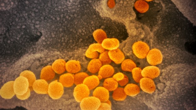 Mikroskopické snímky koronaviru zveřejnili vědci ve čtvrtek