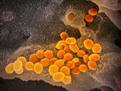 Mikroskopické snímky koronaviru zveejnili vdci ve tvrtek