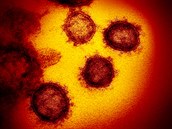 Okraje bunk viru pipomínají korunku, proto se mu íká koronavirus