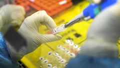 Nemocnice v Brně vyloučila koronavirus u již čtvrtého pacienta