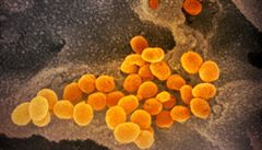 Mikroskopické snímky koronaviru zveřejnili vědci ve čtvrtek | na serveru Lidovky.cz | aktuální zprávy