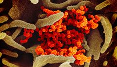 Vědci zveřejnili mikroskopické snímky koronaviru, kvůli testování ho uměle pěstují