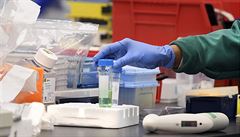 Američané testují vakcínu proti koronaviru. Její uvedení mezi veřejnost ale potrvá minimálně rok