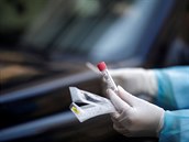 ON-LINE: Počet testů na koronavirus dosáhl na Slovensku nového maxima. Španělsko hlásí 551 obětí za den