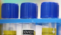 Testy na Covid-19 ve švýcarské laboratoři. | na serveru Lidovky.cz | aktuální zprávy