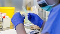 Ústav mikrobiologie Fakultní nemocnice Olomouc, kde se každý den testují vzorky...