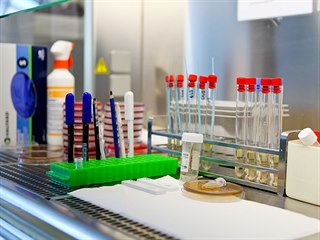 stav mikrobiologie Fakultn nemocnice Olomouc, kde se kad den testuj vzorky...