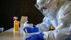 Univerzita Karlova vyvíjí test na chřipku a koronavirus. Dostupný by mohl být za měsíc