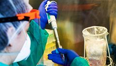 Ministerstvo chce zdit pten s laborato pro testovn na koronavirus. Shn hygieniky