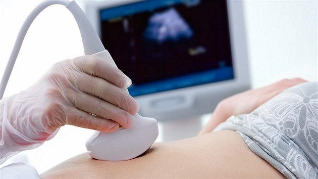 Vyšetření ultrazvukem - ilustrační foto.