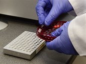 Píprava vzork vytovaných lidí na koronavirus k vloení do standardního PCR...