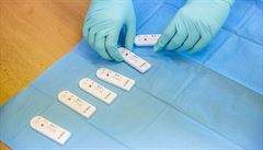 Praktit lkai otestuj antigennmi testy na covid-19 patrn jen sv registrovan pacienty