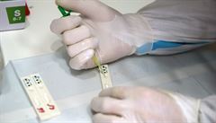 Antigenní testování bude podle ministerstva zdravotnictví pokračovat i po 15. lednu