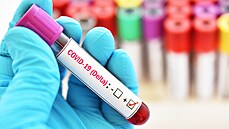 Podl varianty koronaviru delta v esku podle Sttnho zdravotnho stavu roste