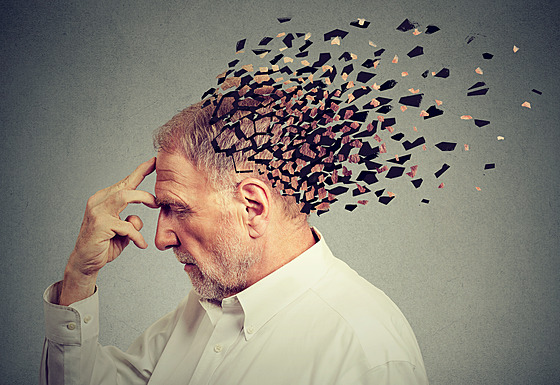 Alzheimerova choroba (ilustraní foto)