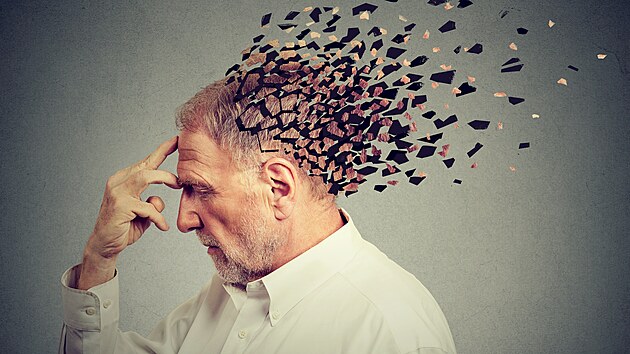 Alzheimerova choroba (ilustraní foto)