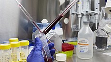 ÚHKT je hematologické centrum excelence v �esku. Sídlí v srdci Prahy na Karlov�...