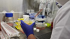 ÚHKT je hematologické centrum excelence v �esku. Sídlí v srdci Prahy na Karlov�...