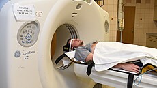 CT vyšetření mozku