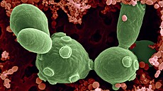 Buňky kvasinky Saccharomyces cerevisiae mezi bakteriemi v kvašené ovocné šťávě