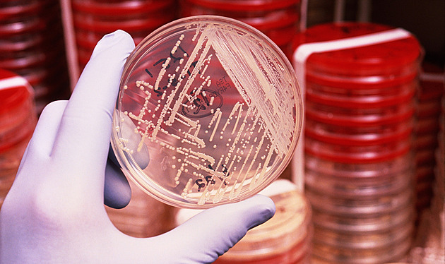 Česko doveze superantibiotika. Při nákaze velmi odolnými bakteriemi pomůže patnáct druhů léků poslední záchrany