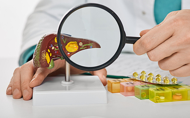 Ztráta obezřetnosti. Jak v téhle atmosféře lidi motivovat, když se na hepatitidu typu C neumírá?