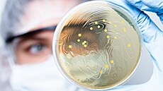 Mikrobiom ovlivuje rovn fyzick vkon